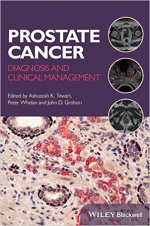Prostate Cancer Diagnosis and Clinical Management