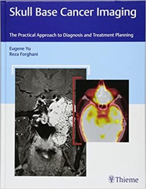 Skull Base Cancer Imaging The Practical Approach to Diagnosis and Treatment Planning