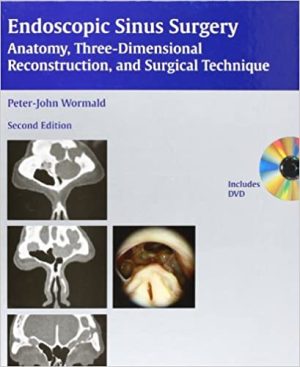 Endoscopic Sinus Surgery Anatomy Three Dimensional Reconstruction and Surgical Technique 2nd Edition
