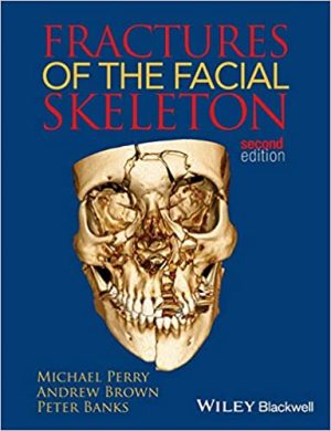Fractures of the Facial Skeleton 2nd Edition By Peter Banks