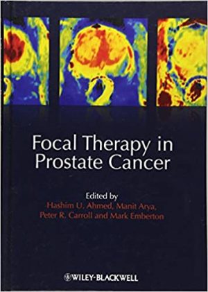 Focal Therapy in Prostate Cancer