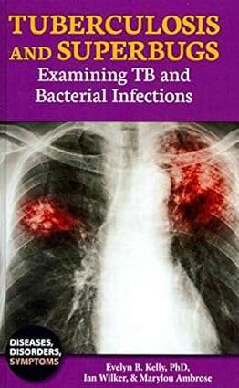Tuberculosis and Superbugs Examining TB and Bacterial Infections