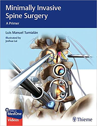 Minimally Invasive Spine Surgery A Primer