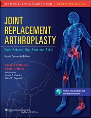 Joint Replacement Arthroplasty Basic Science Hip Knee and Ankle