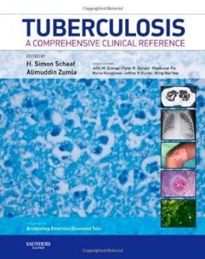 Tuberculosis A Comprehensive Clinical Reference