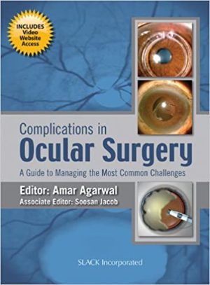 Complications in Ocular Surgery A Guide to Managing the Most Common Challenges
