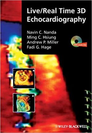 Live Real Time 3D Echocardiography