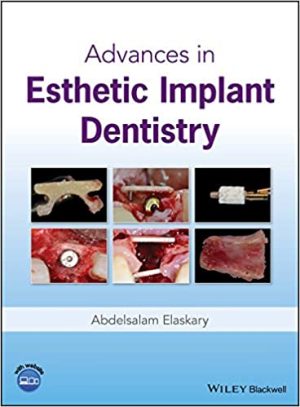 Advances In Esthetic Implant Dentistry