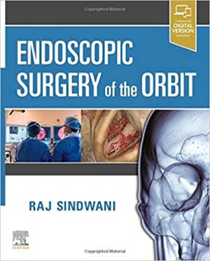 Endoscopic Surgery of the Orbit By Raj Sindwani