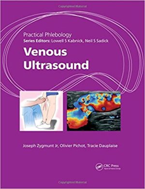 Practical Phlebology Venous Ultrasound