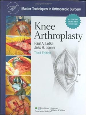 Master Techniques in Orthopaedic Surgery Knee Arthroplasty 3rd Edition