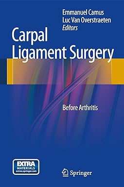 Carpal Ligament Surgery Before Arthritis
