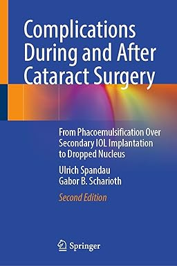 Complications During and After Cataract Surgery From Phacoemulsification Over Secondary IOL Implantation 2nd Edition