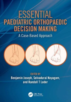 Essential Paediatric Orthopaedic Decision Making A Case Based Approach