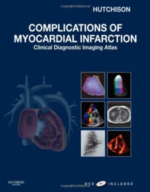 Complications of Myocardial Infarction Clinical Diagnostic Imaging Atlas