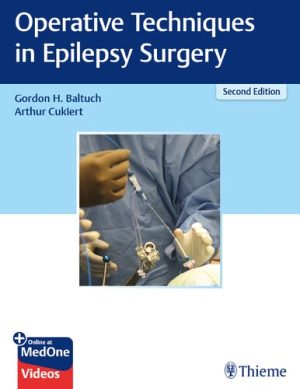 Operative Techniques in Epilepsy Surgery 2nd Edition