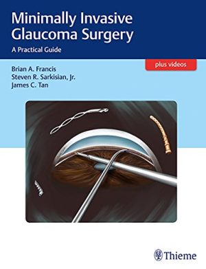 Minimally Invasive Glaucoma Surgery A Practical Guide