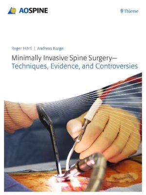 Minimally Invasive Spine Surgery Techniques Evidence and Controversies