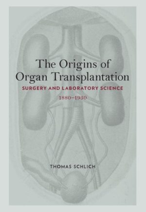 The Origins of Organ Transplantation Surgery and Laboratory Science 1880 1930