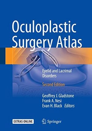 Oculoplastic Surgery Atlas Eyelid and Lacrimal Disorders 2nd Edition
