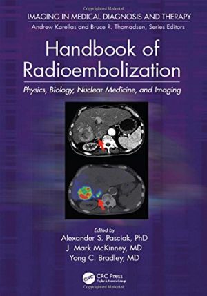 Handbook of Radioembolization Physics Biology Nuclear Medicine and Imaging