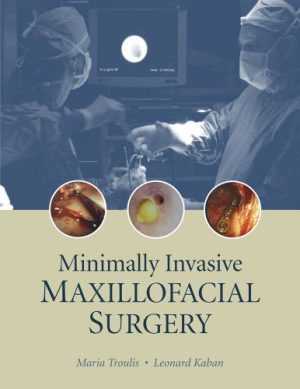 Minimally Invasive Maxillofacial Surgery By Maria Troulis