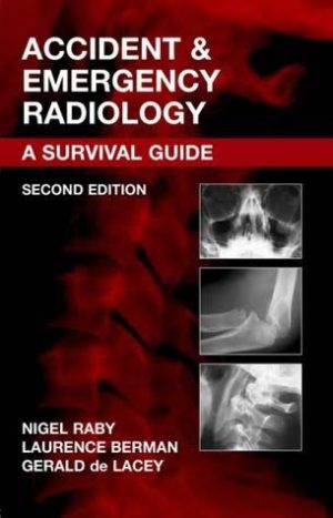 Accident & Emergency Radiology A Survival Guide